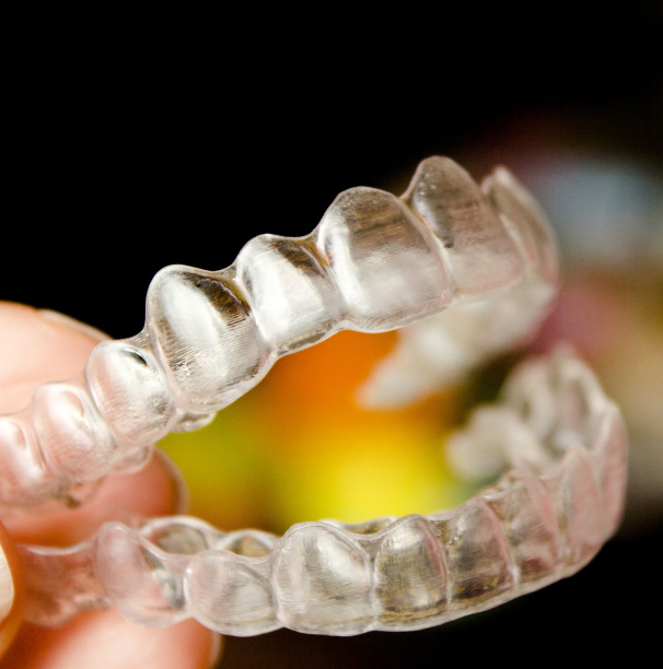 vivera aligners