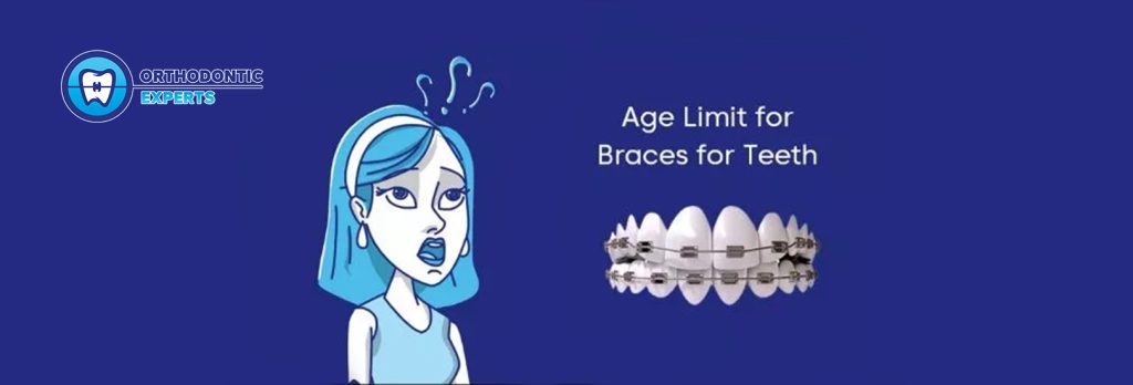 Age Limit For Braces For Teeth