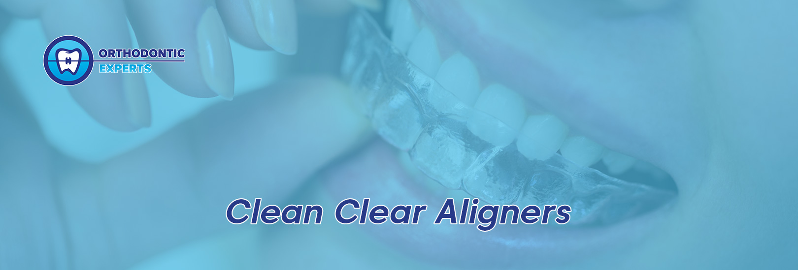 How To Clean Clear Retainers