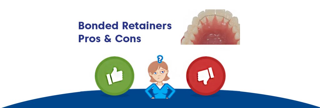 Bonded Retainers Pros & Cons