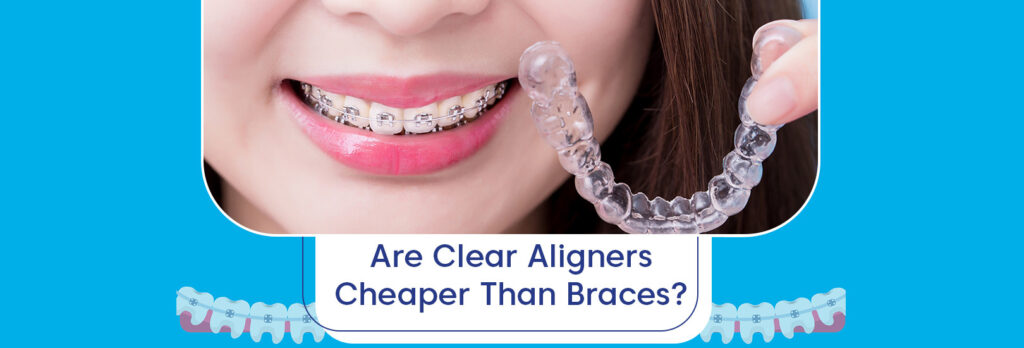 Is Clear Aligners Cheaper Than Braces