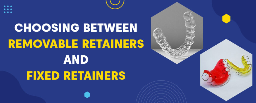 Choosing Between Removable Retainers And Fixed Retainers