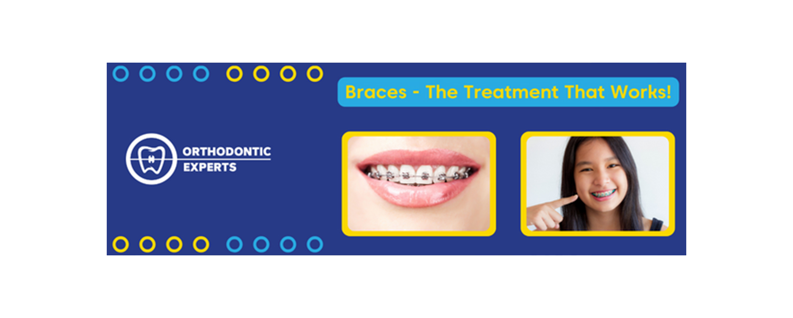 Braces the Treatment That Works